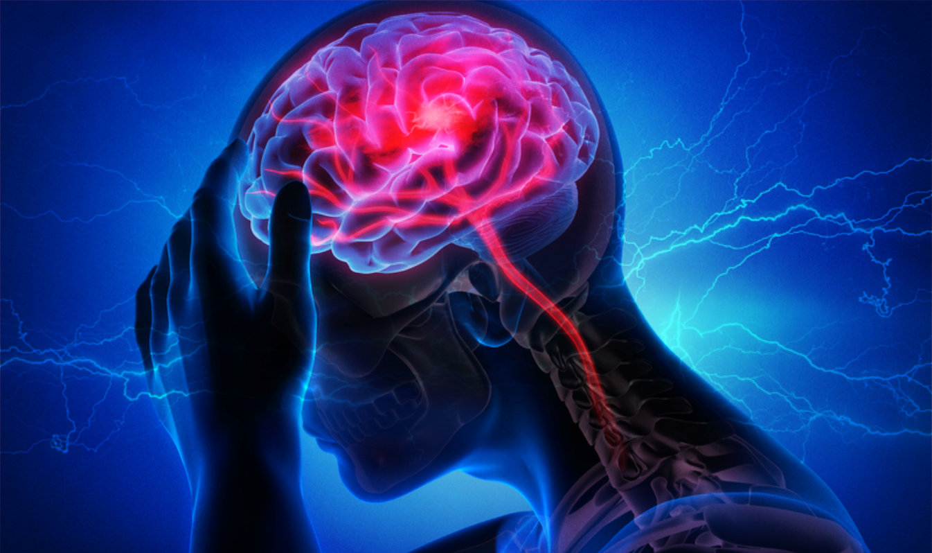 Stroke